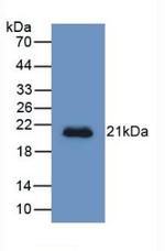 HFE2 Antibody in Western Blot (WB)