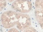 GREM1 Antibody in Immunohistochemistry (Paraffin) (IHC (P))