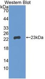 GREM1 Antibody in Western Blot (WB)