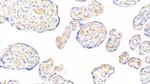 FIBB Antibody in Immunohistochemistry (Paraffin) (IHC (P))