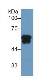 FIBB Antibody in Western Blot (WB)