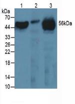 FIBB Antibody in Western Blot (WB)