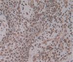 ENPP2 Antibody in Immunohistochemistry (Paraffin) (IHC (P))