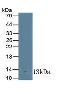 IL10RA Antibody in Western Blot (WB)