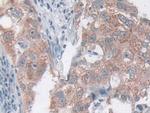 CCL20 Antibody in Immunohistochemistry (Paraffin) (IHC (P))