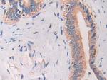 Cathelicidin Antibody in Immunohistochemistry (Paraffin) (IHC (P))