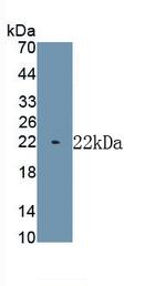 MYH7 Antibody in Western Blot (WB)