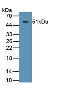 ASPH Antibody in Western Blot (WB)