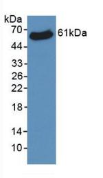 VDAC Antibody in Western Blot (WB)