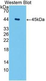 Aquaporin 4 Antibody in Western Blot (WB)