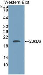 Adrenomedullin Antibody in Western Blot (WB)