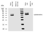 Cytokeratin 4/5/6/8/10/13/18 Antibody in Western Blot (WB)