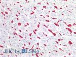 CD235a Antibody in Immunohistochemistry (Paraffin) (IHC (P))