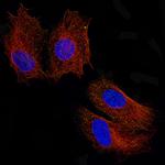 Periostin Antibody in Immunocytochemistry (ICC/IF)