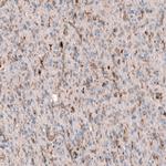 Periostin Antibody in Immunohistochemistry (Paraffin) (IHC (P))