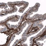 Periostin Antibody in Immunohistochemistry (Paraffin) (IHC (P))