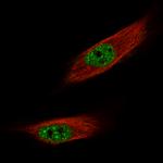 FOXM1 Antibody in Immunocytochemistry (ICC/IF)