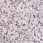 FOXM1 Antibody in Immunohistochemistry (Paraffin) (IHC (P))