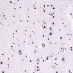 FOXM1 Antibody in Immunohistochemistry (Paraffin) (IHC (P))