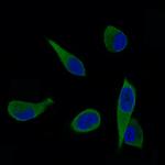 ALDH1A3 Antibody in Immunocytochemistry (ICC/IF)