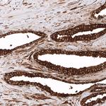 ALDH1A3 Antibody in Immunohistochemistry (Paraffin) (IHC (P))