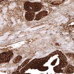 ALDH1A3 Antibody in Immunohistochemistry (Paraffin) (IHC (P))