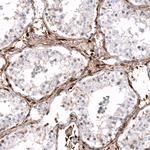 ALDH1A3 Antibody in Immunohistochemistry (Paraffin) (IHC (P))