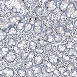 INSM1 Antibody in Immunohistochemistry (Paraffin) (IHC (P))