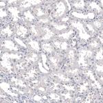 INSM1 Antibody in Immunohistochemistry (Paraffin) (IHC (P))