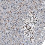 INSM1 Antibody in Immunohistochemistry (Paraffin) (IHC (P))