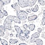 INSM1 Antibody in Immunohistochemistry (Paraffin) (IHC (P))