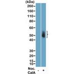 Phospho-Aurora A/B/C (Thr288, Thr232, Thr198) Antibody in Western Blot (WB)