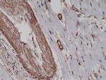 Alpha-Smooth Muscle Actin Antibody in Immunohistochemistry (Paraffin) (IHC (P))