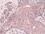 SMAD4 Antibody in Immunohistochemistry (Paraffin) (IHC (P))