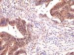 SMAD4 Antibody in Immunohistochemistry (Paraffin) (IHC (P))