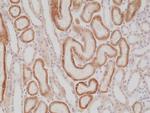 AMACR Antibody in Immunohistochemistry (Paraffin) (IHC (P))