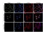 JMJD1B Antibody in Immunocytochemistry (ICC/IF)