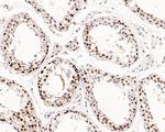 JMJD1B Antibody in Immunohistochemistry (Paraffin) (IHC (P))