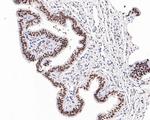 JMJD1B Antibody in Immunohistochemistry (Paraffin) (IHC (P))