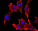 Tyrosinase Antibody in Immunocytochemistry (ICC/IF)