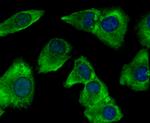 gamma Tubulin Antibody in Immunocytochemistry (ICC/IF)