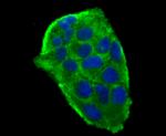 gamma Tubulin Antibody in Immunocytochemistry (ICC/IF)