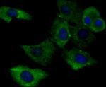 gamma Tubulin Antibody in Immunocytochemistry (ICC/IF)