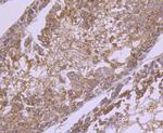 GRP75 Antibody in Immunohistochemistry (Paraffin) (IHC (P))