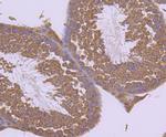 GRP75 Antibody in Immunohistochemistry (Paraffin) (IHC (P))