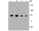 GRP75 Antibody in Western Blot (WB)