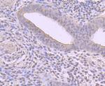 Cyclin A2 Antibody in Immunohistochemistry (Paraffin) (IHC (P))