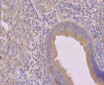 Cyclin A2 Antibody in Immunohistochemistry (Paraffin) (IHC (P))