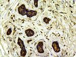 JAK2 Antibody in Immunohistochemistry (Paraffin) (IHC (P))