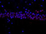 Histone H3 Antibody in Immunohistochemistry (Paraffin) (IHC (P))